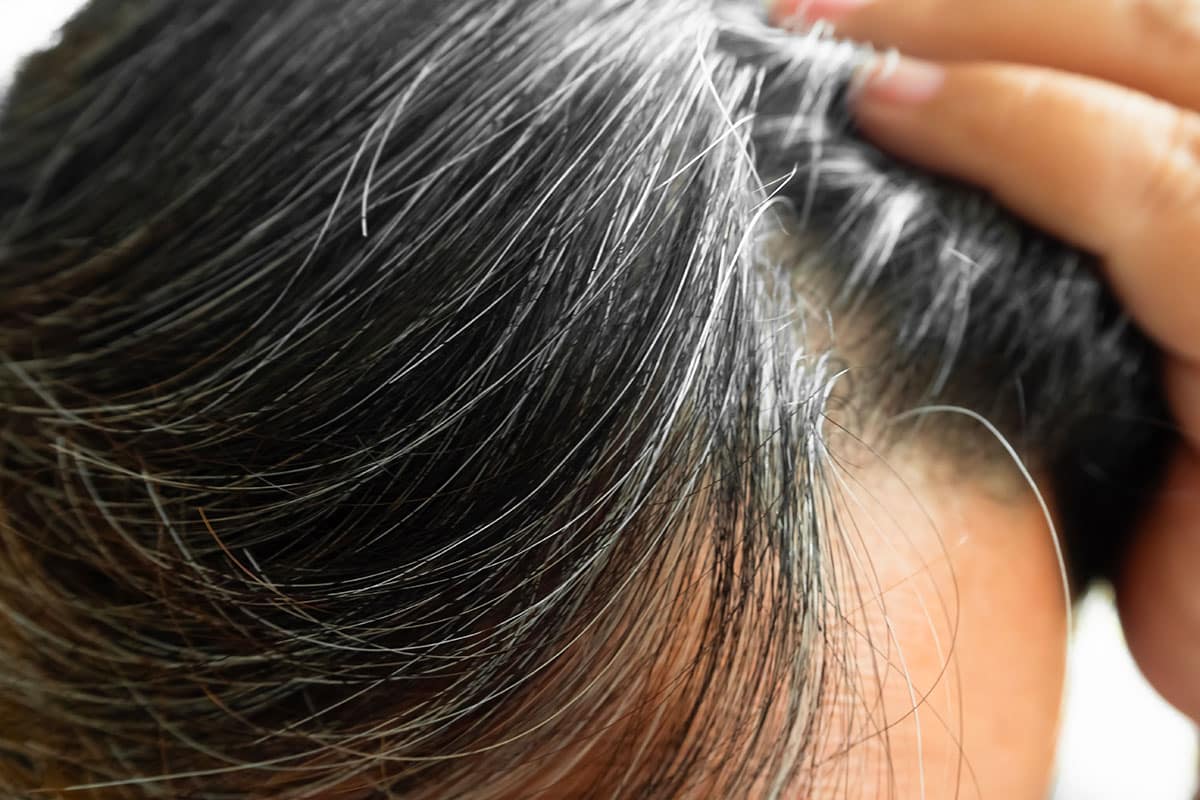 Understanding gray hair: causes and solutions